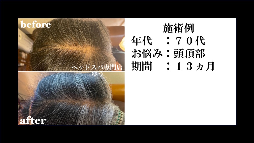 Before & After 11