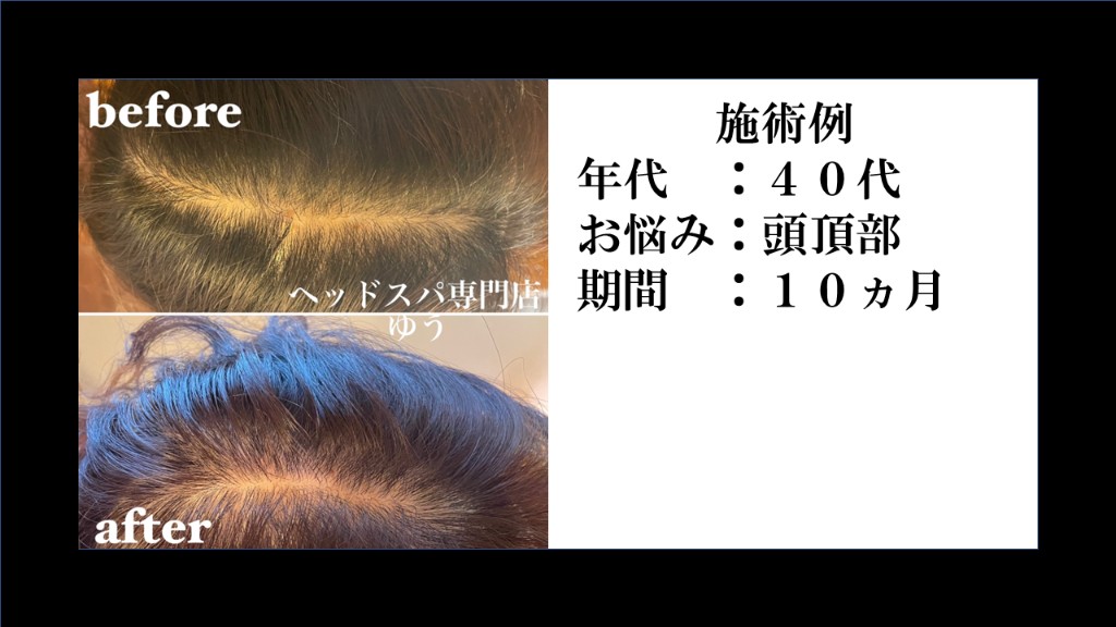 Before & After 12