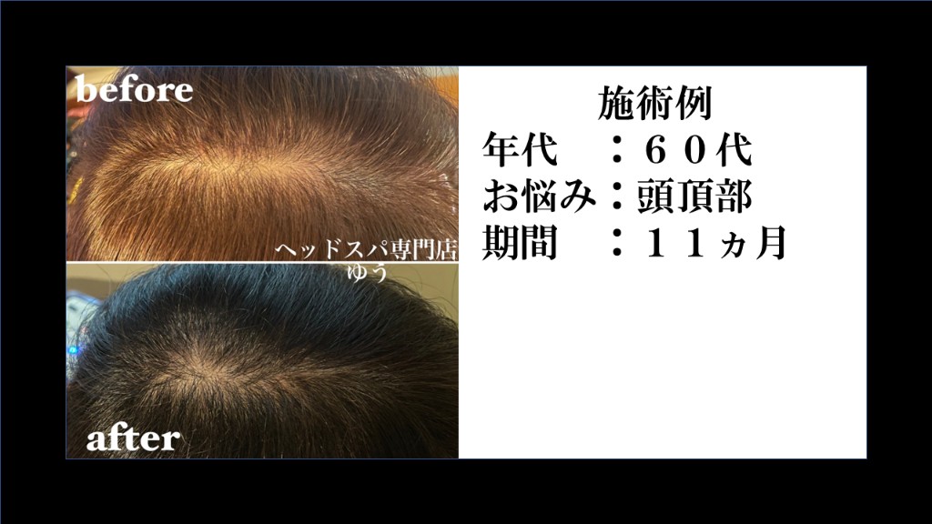 Before & After 20